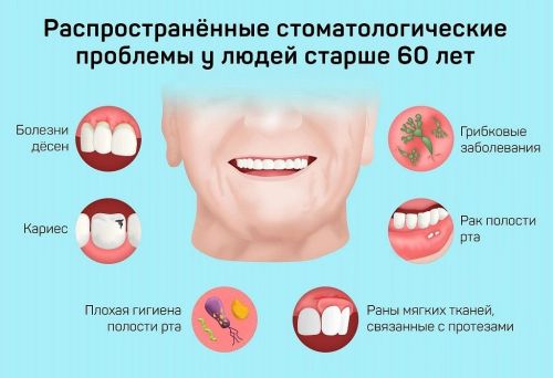 Неделя ответственного отношения к здоровью полости рта: советы для пожилых